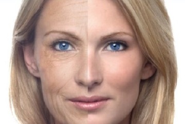 Resurfacing facial